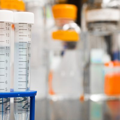 Analisi di Laboratorio Crema, Cremona, Milano, Brescia, Bergamo e Lodi Analisi di Laboratorio Crema, Cremona, Milano, Brescia, Bergamo e Lodi